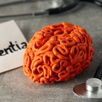 Early Signs of Dementia